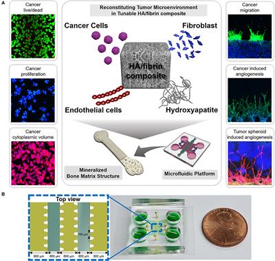 3D Microfluidic Bone Tumor Microenvironment Comprised of Hydroxyapatite/Fibrin Composite